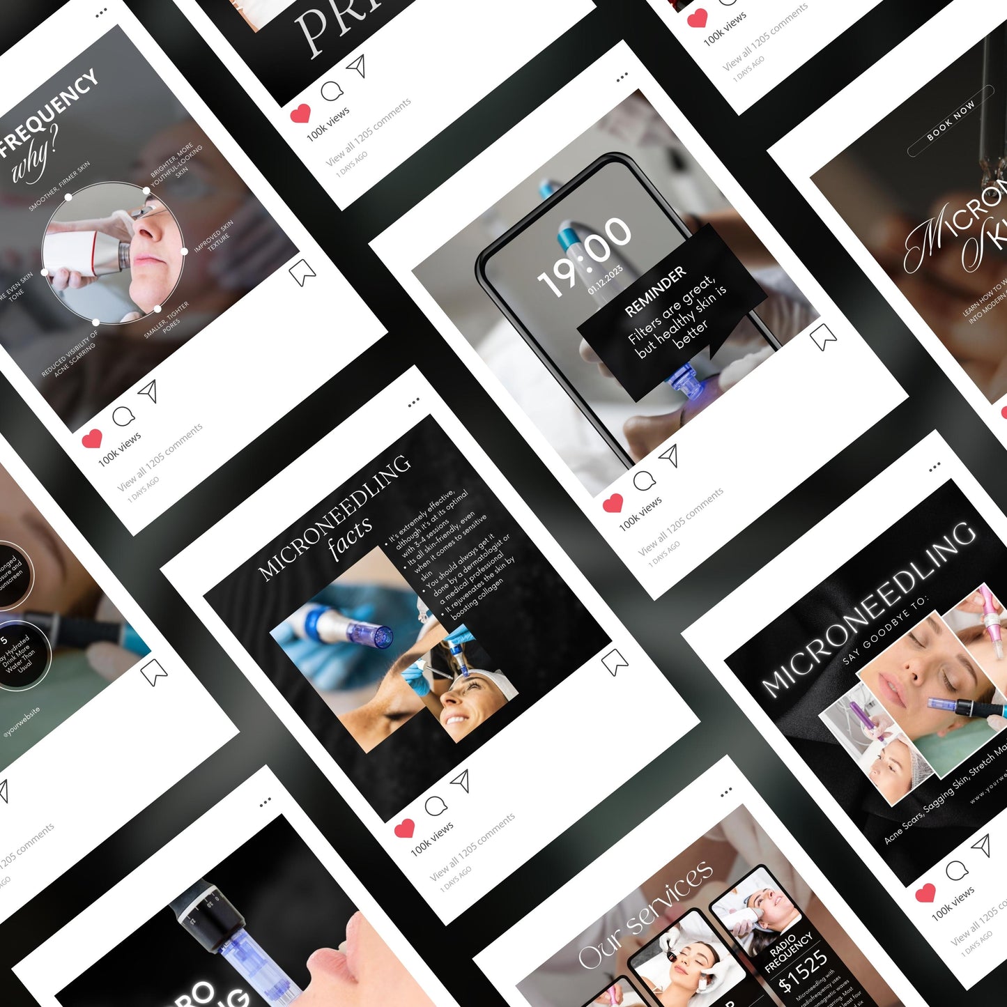 100 modèles Instagram de microneedling