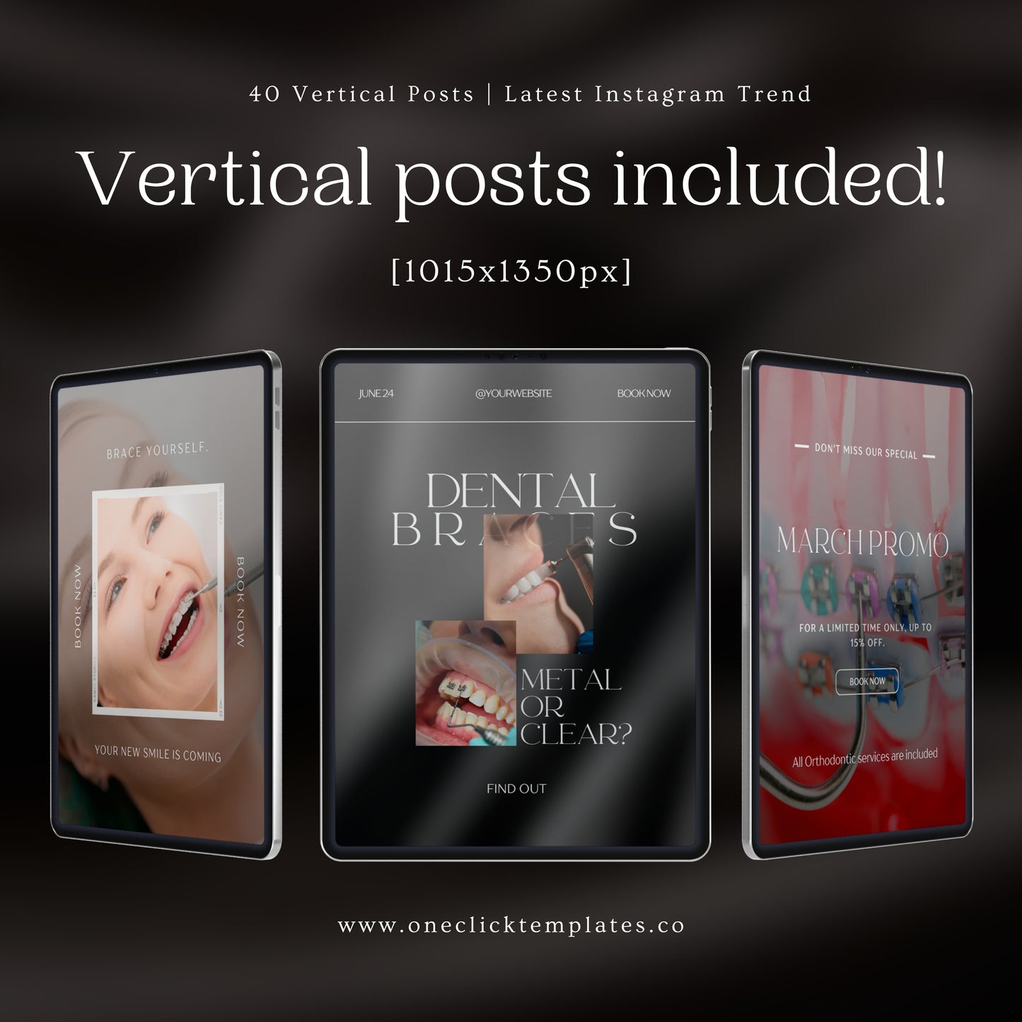 80 Dental Braces Instagram Templates