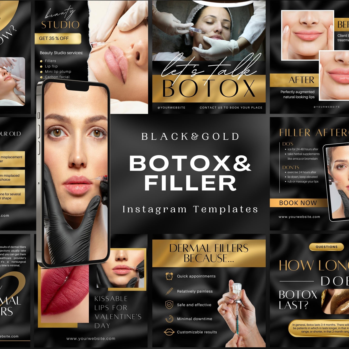 70 Gold Botox&Filler Instagram Templates