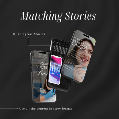 80 Dental Veneers Instagram Templates